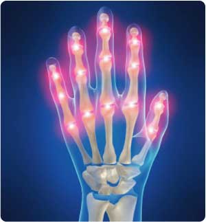 liječenje artritisa i artroze nožnih prstiju